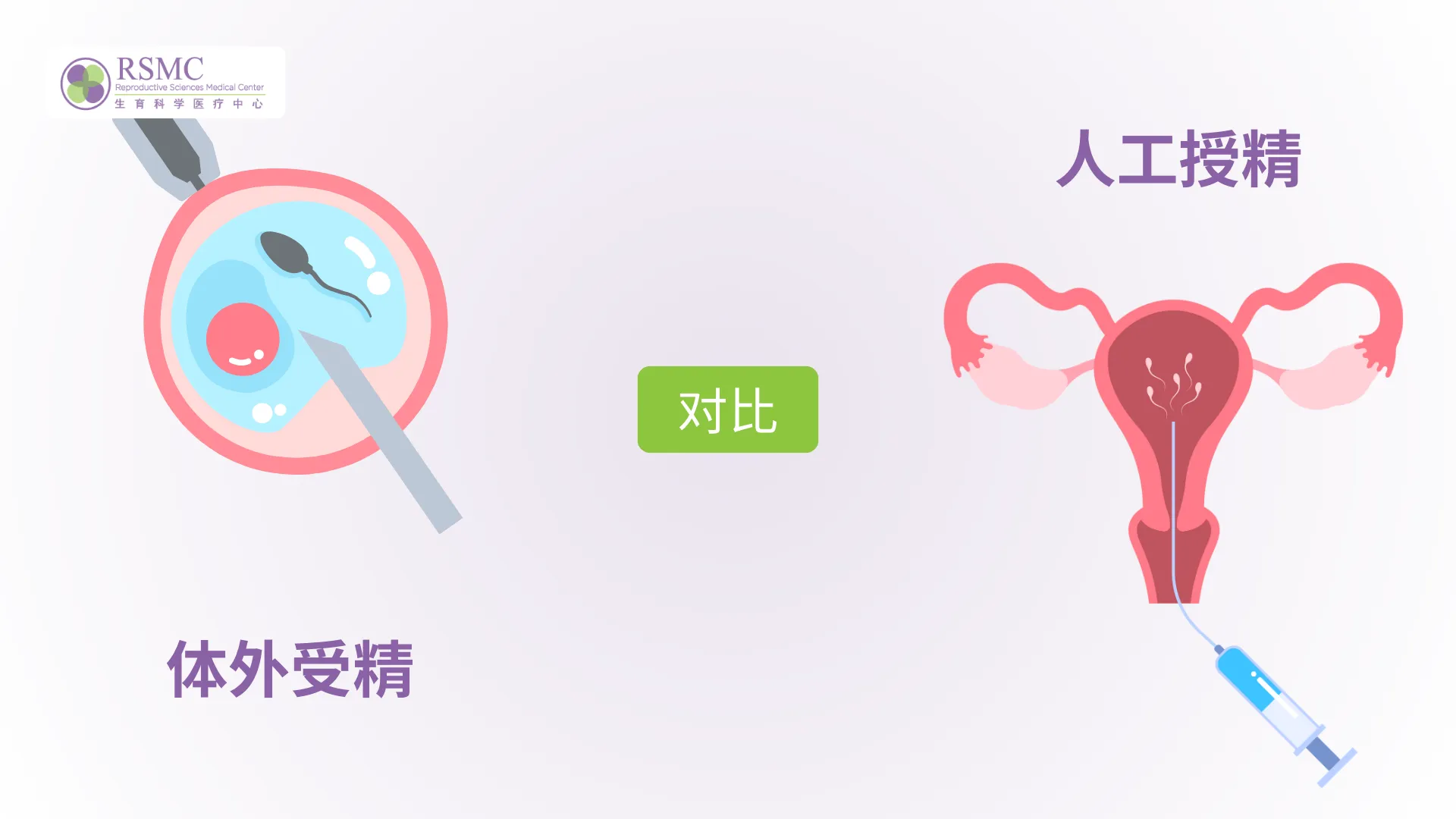 人工授精与试管婴儿：优缺点及如何选择
